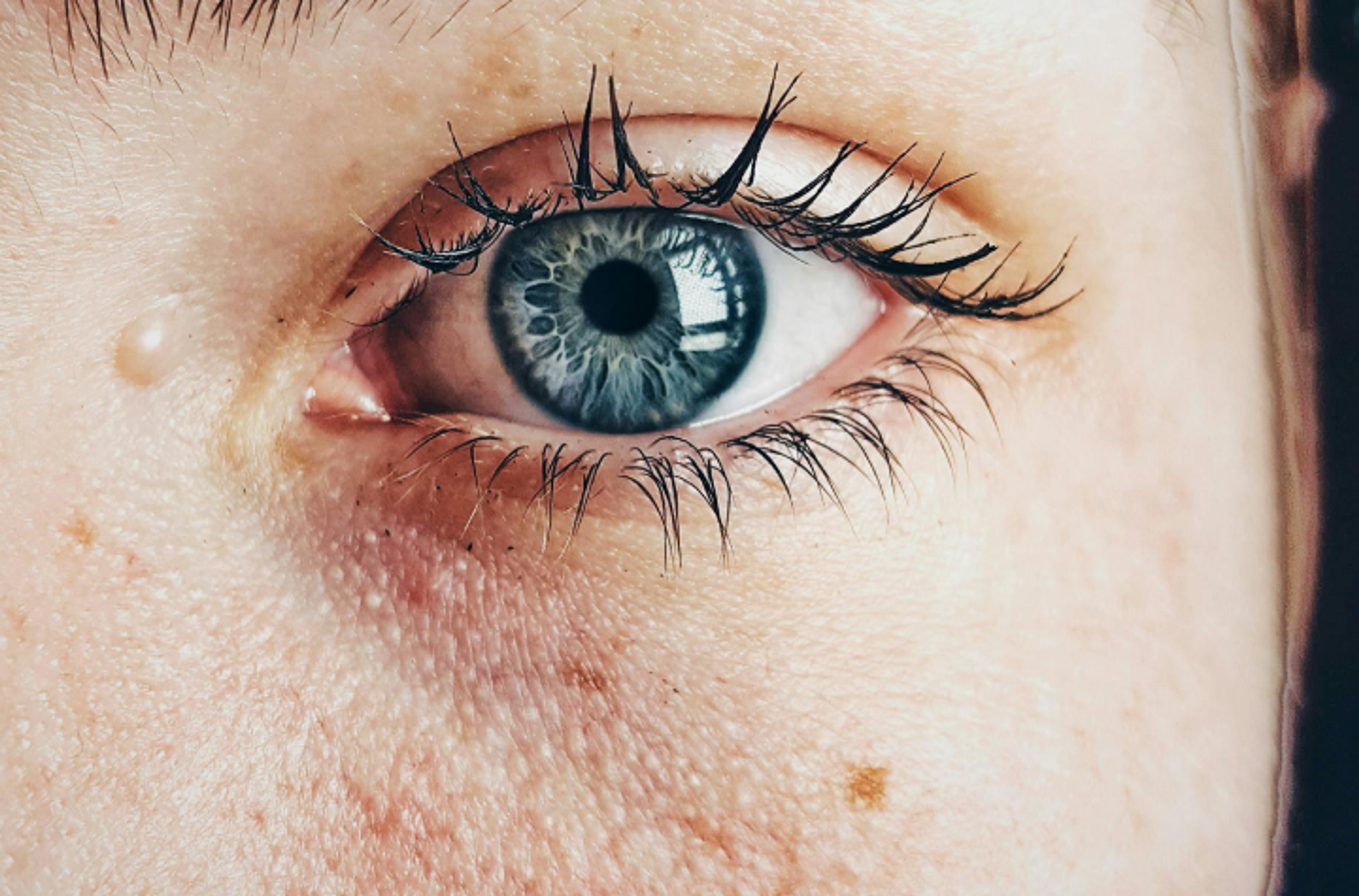 Dermatologické zákroky